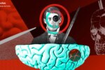 Cráneo de Phineas Gage con barra de hierro que atravesó su corteza prefrontal, clave en neurociencia
